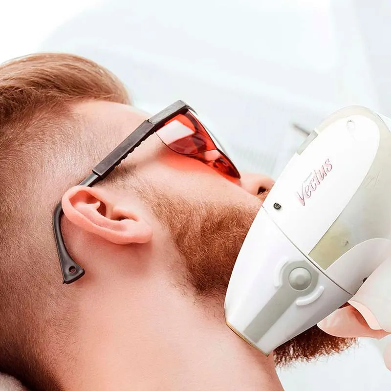 Depilación láser en cuello y barba en hombre con tecnología láser profesional