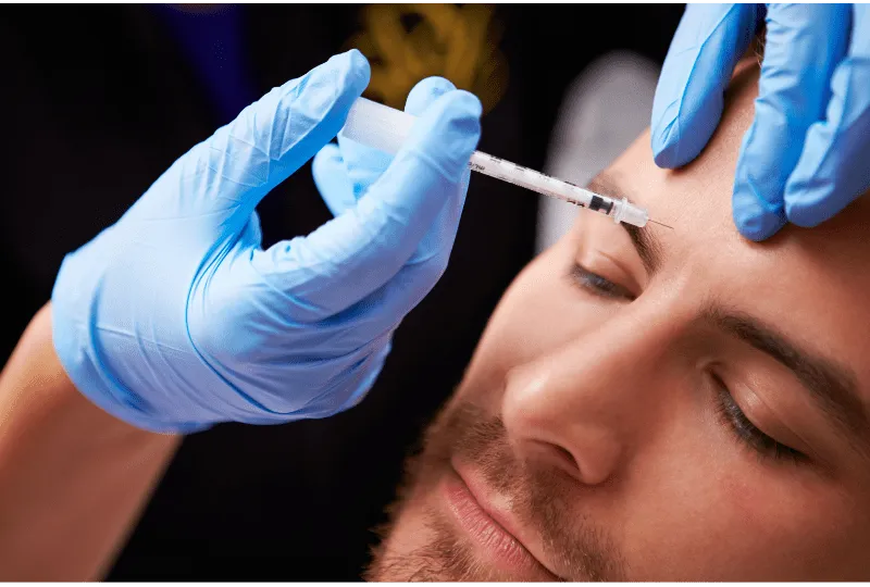 Neuromoduladores en frente y entrecejo para suavizar líneas