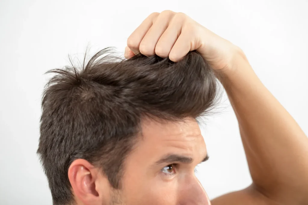 Mesoterapia capilar para estimular el crecimiento del cabello