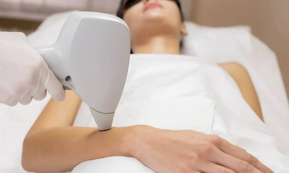 Tratamiento de depilación láser en brazos y axilas con tecnología avanzada