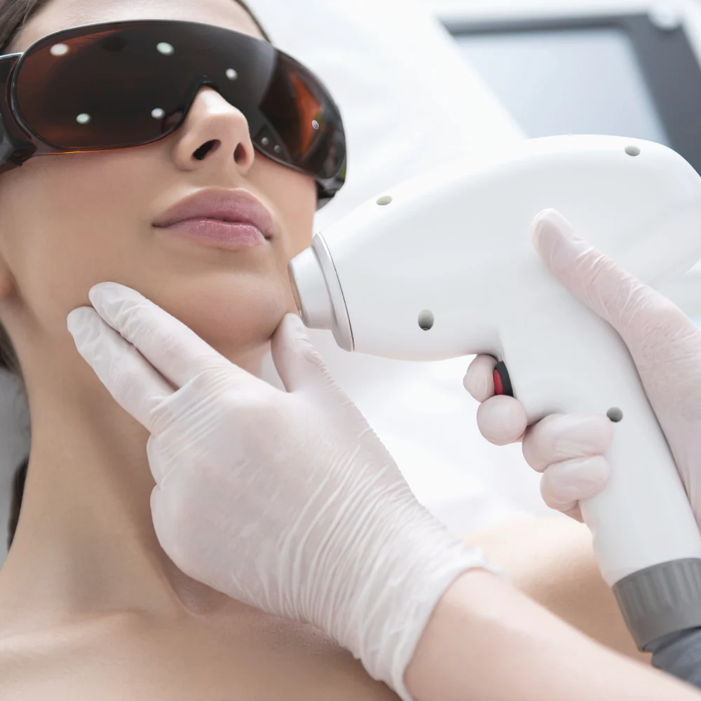mujer recibiendo tratamiento de depilación láser en mentón y cuello con equipo profesional para eliminación permanente del vello facial