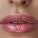 AUMENTO DE LABIO ( RELLENO CON ÁCIDO HIALURÓNICO )