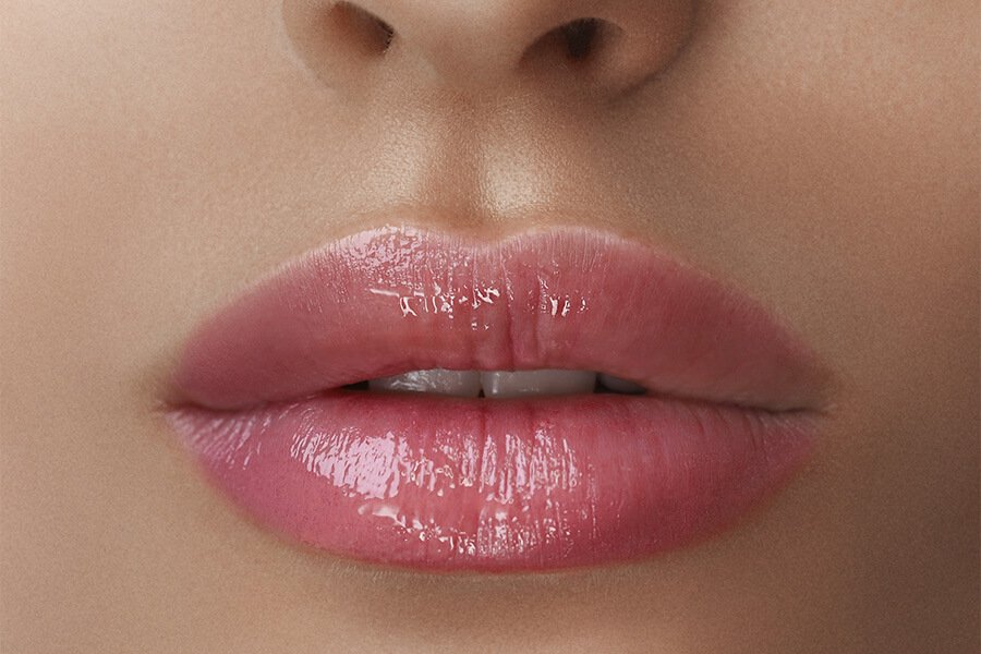 Aumento de labios