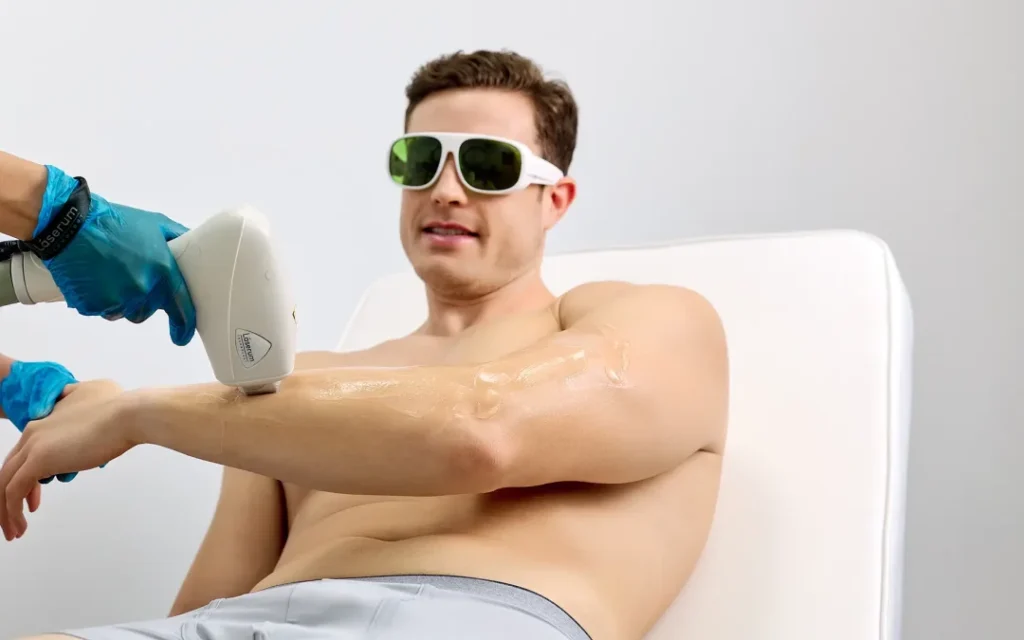 Depilación láser de cuerpo completo en hombre, tratamiento en brazo con equipo profesional
