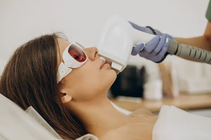 Depilación láser facial en mujer en zona de cuello y mentón con equipo especializado