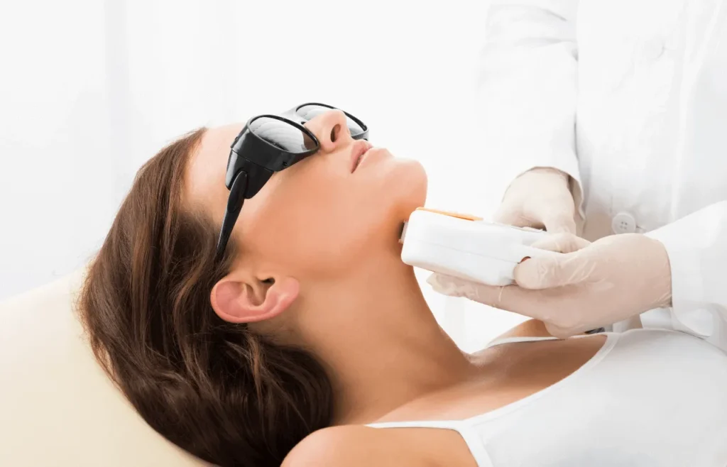 mujer recibiendo tratamiento de depilación láser en mentón con equipo profesional para eliminación permanente del vello facial