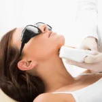 mujer recibiendo tratamiento de depilación láser en mentón con equipo profesional para eliminación permanente del vello facial