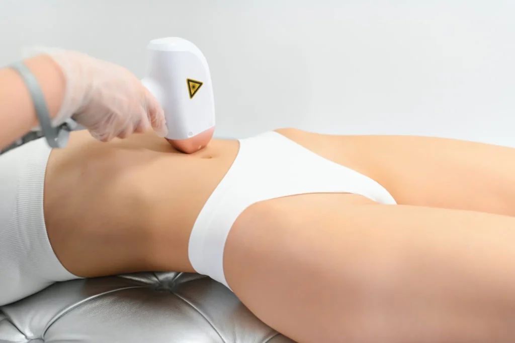 esteticista aplicando depilación láser en piernas de mujer con equipo profesional para eliminación permanente del vello