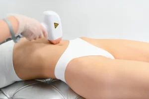 esteticista aplicando depilación láser en piernas de mujer con equipo profesional para eliminación permanente del vello