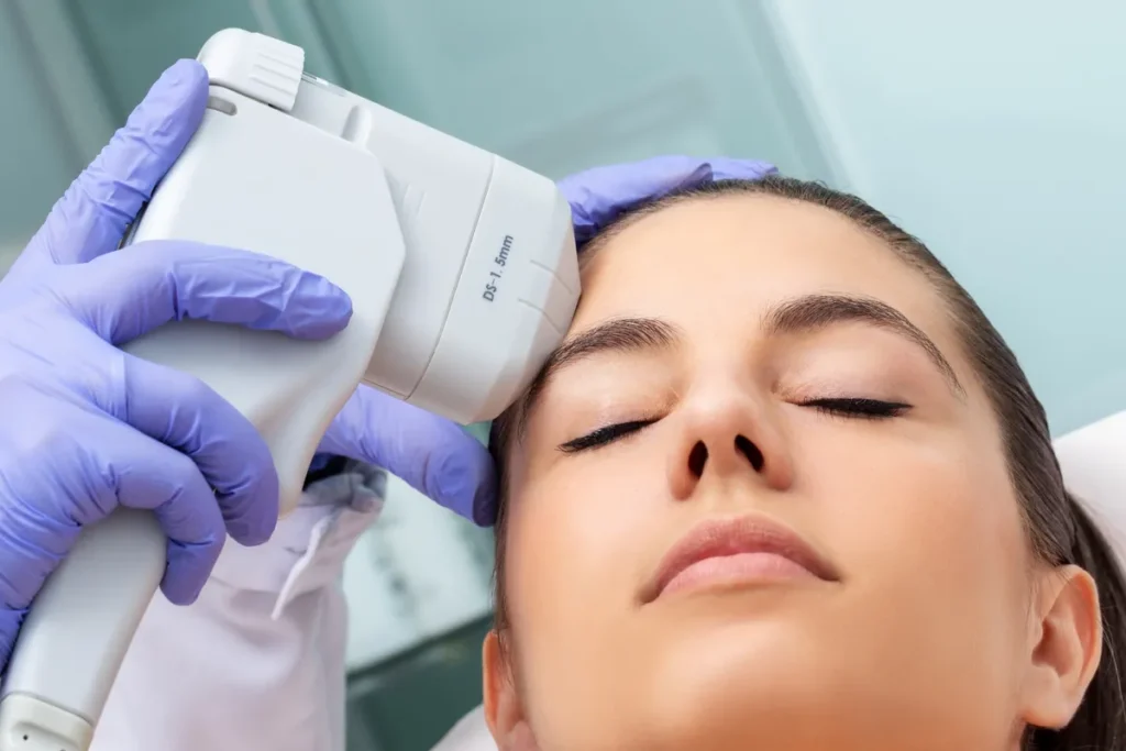Tratamiento HIFU facial en mujer con equipo de ultrasonido focalizado profesional