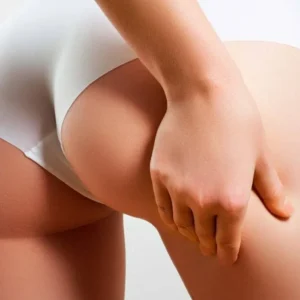 Depilación láser en glúteos en mujer mostrando área específica de tratamiento