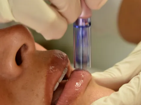 Hidratación de labios con ácido hialurónico para mayor volumen y frescura