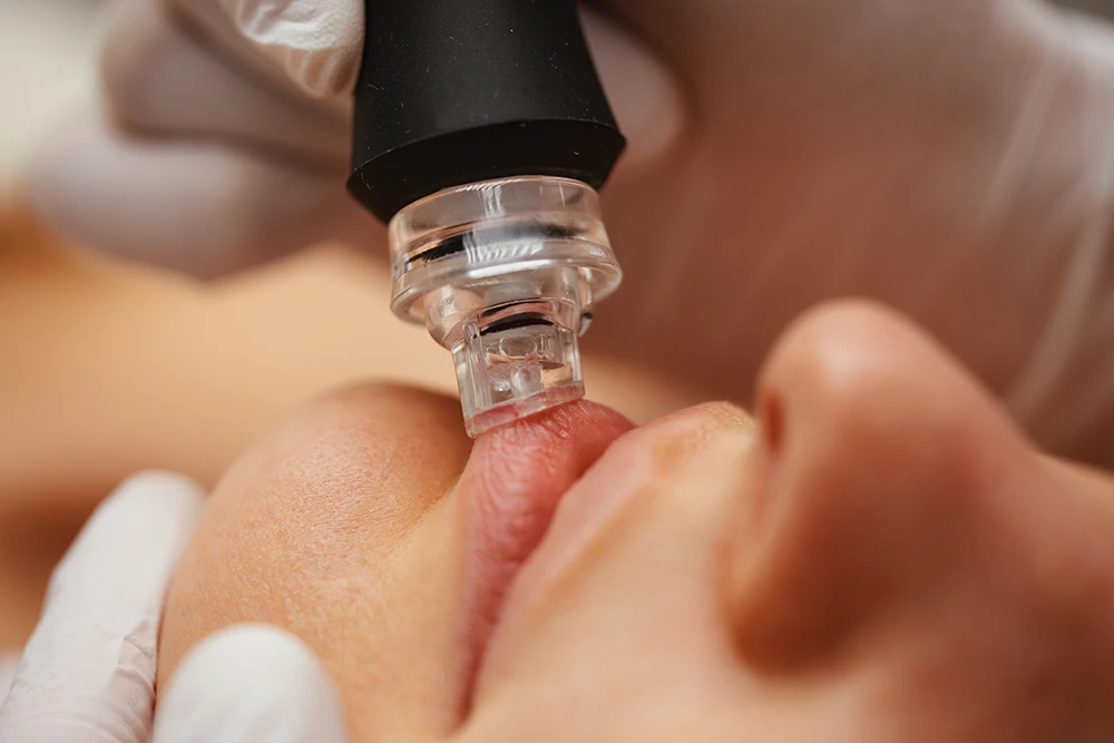 Hidratación de Labios