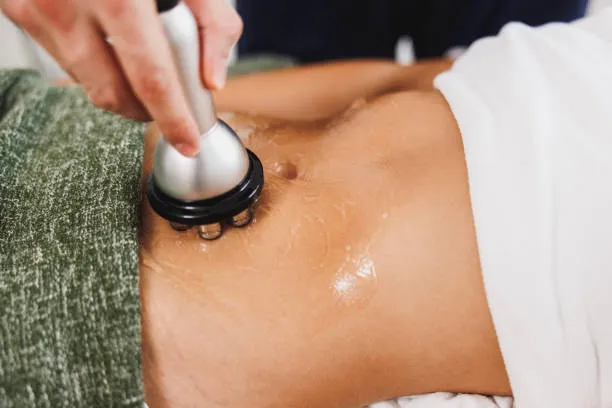 esteticista aplicando tratamiento de radiofrecuencia corporal en espalda con cabezal profesional para reafirmar la piel y mejorar la textura cutánea