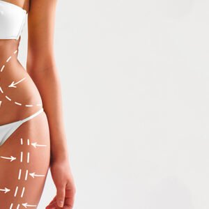 MESOTERAPIA CORPORAL