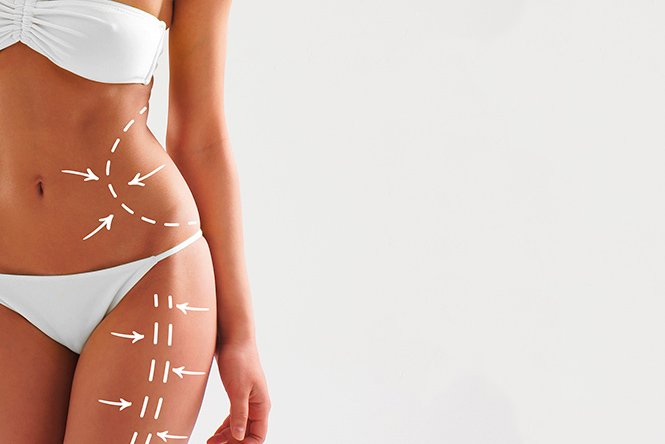 MESOTERAPIA CORPORAL