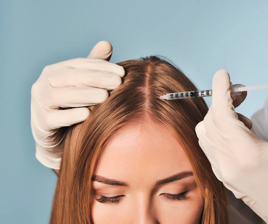 Mesoterapia capilar para fortalecer el cabello y prevenir la caída