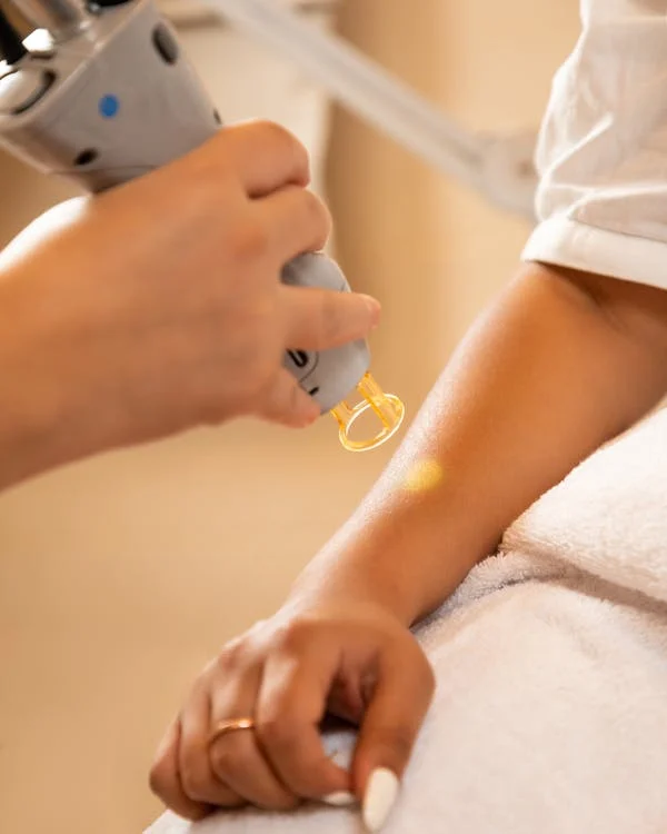 esteticista aplicando depilación láser en brazo completo con aparato profesional para eliminación permanente del vello