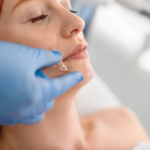 Láser diodo en labio para eliminar el vello facial