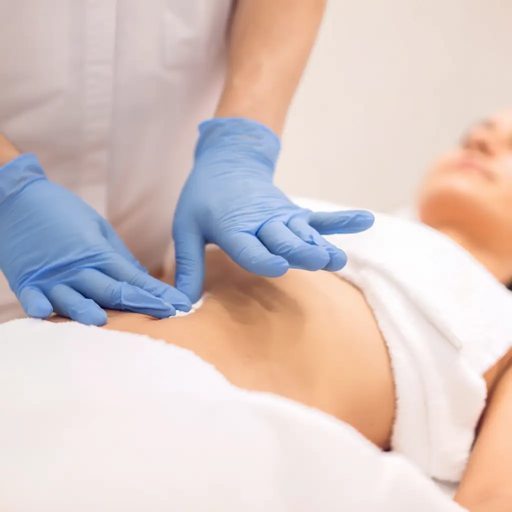 Depilación de línea alba con láser diodo para mujeres