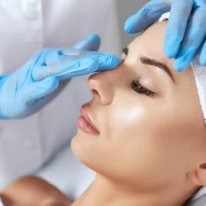 Rinomodelación para mejorar el perfil nasal sin cirugía