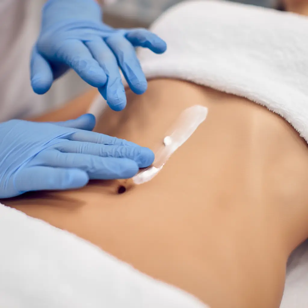 Tratamiento láser diodo en línea alba para una piel suave