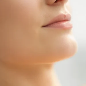 Depilación del mentón con láser diodo para mujeres