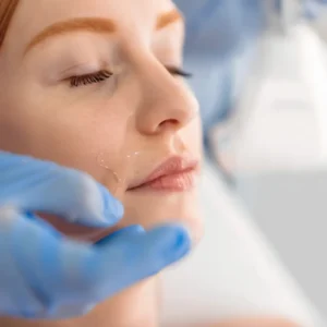 Tratamiento láser diodo en labio para una piel suave y cuidada