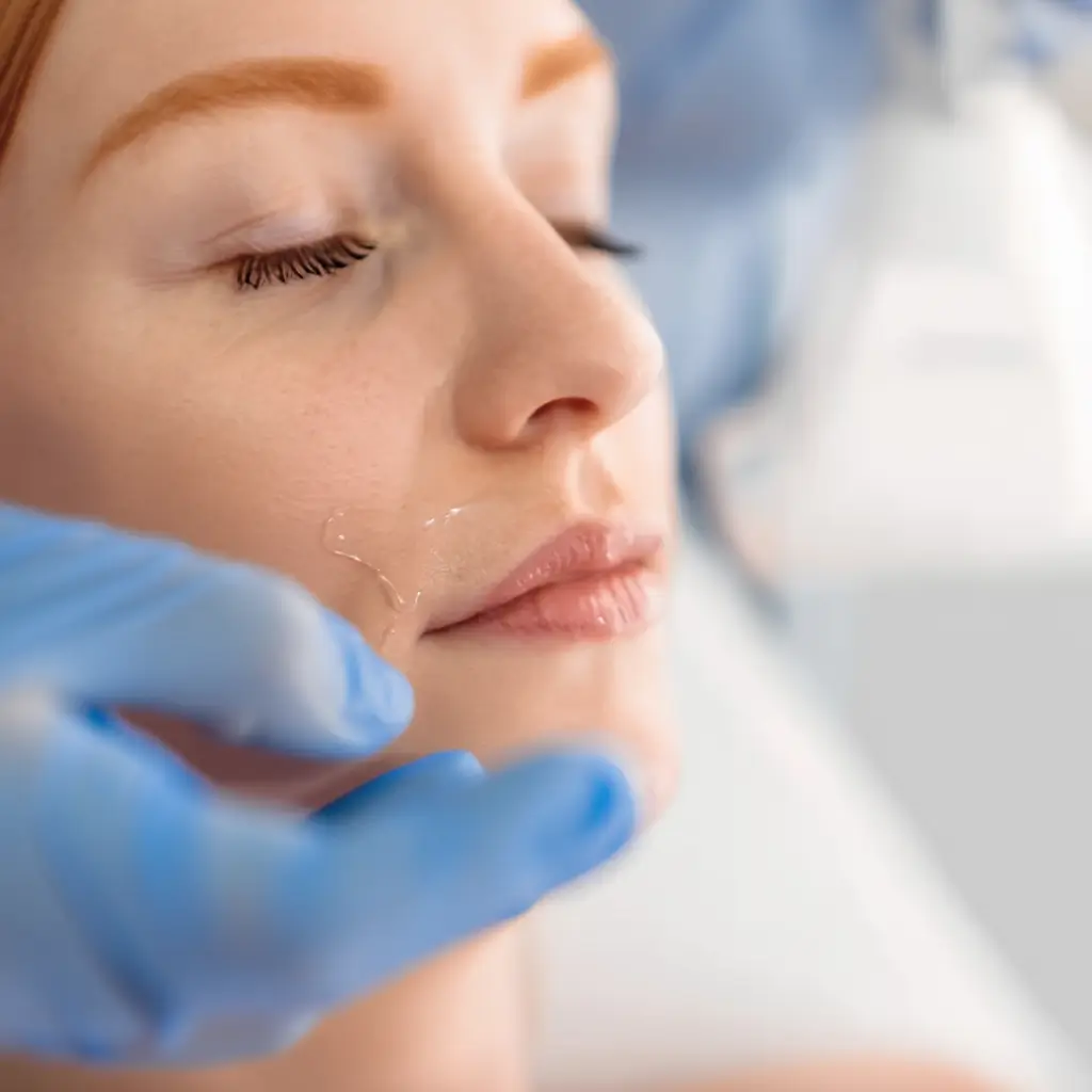 Tratamiento láser diodo en labio para una piel suave y cuidada