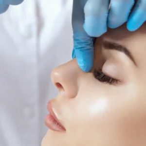 Tratamiento de rinomodelación para mejorar la forma nasal