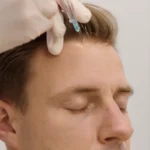 PRP capilar para estimular el crecimiento del cabello