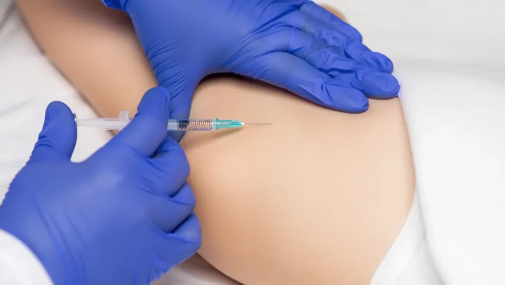 Antes y después de tratamiento de escleroterapia mostrando reducción de arañas vasculares.